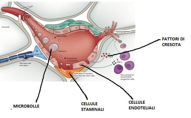 Terapia a Onde d’urto LIESWT Studio Medico Andrea Curreli