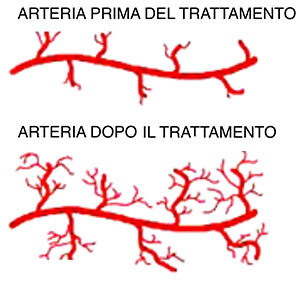 Trattamento a onde d'urto (Liewst)