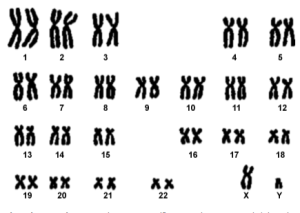 genetica ed infertilità maschile 